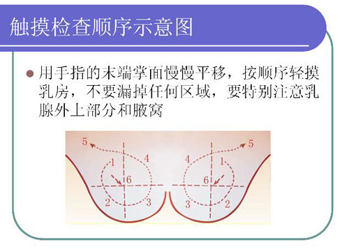 注意 是按压,而非抓,捏的手法,因为任何正常的乳腺腺体,在被抓捏,提拉